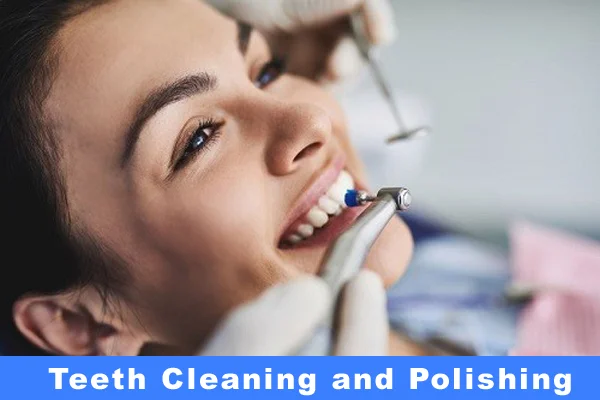 Teeth Cleaning and Polishing